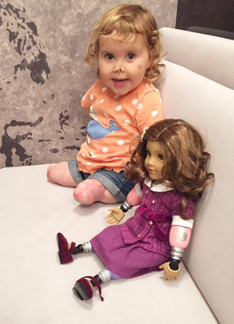 Quadruple-amputee toddler receives look-alike doll.