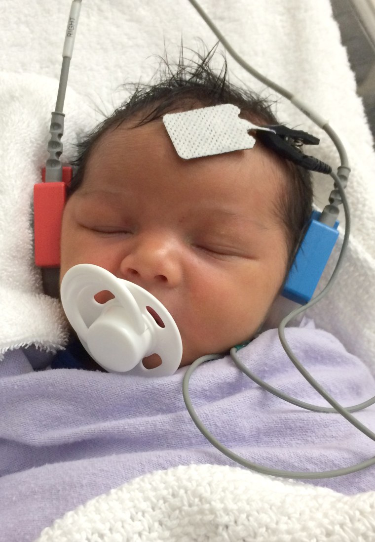 Three-Month-Old Australian Baby Jordan Hears For The First Time