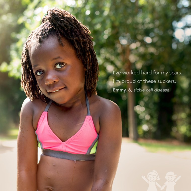 kids show off their scars in photo series