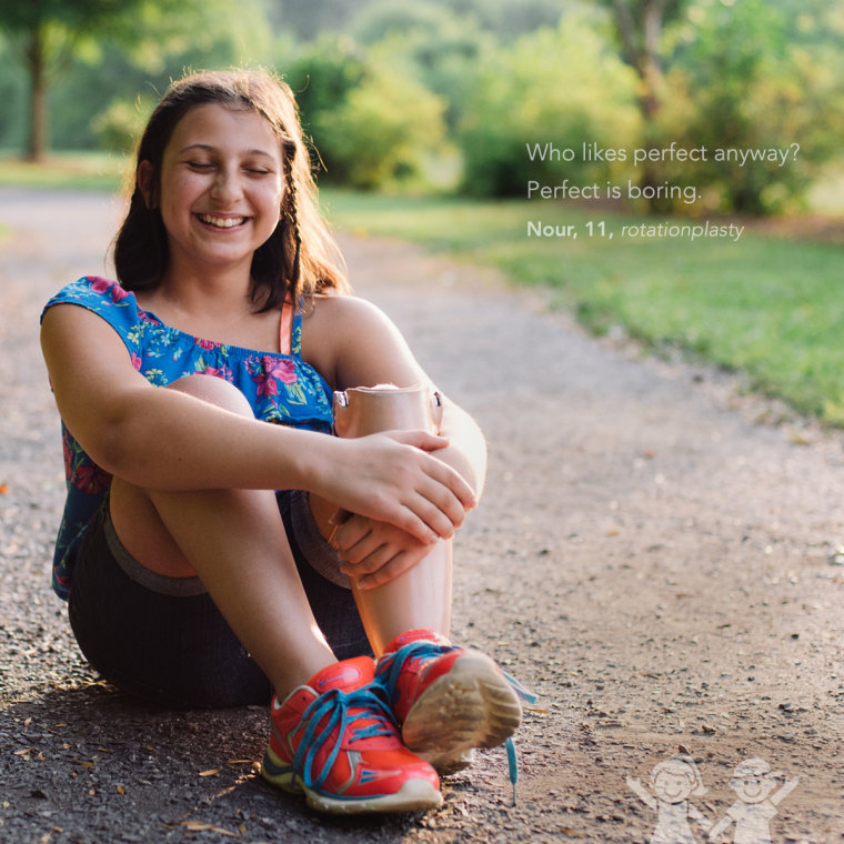 kids show off scars in photo series