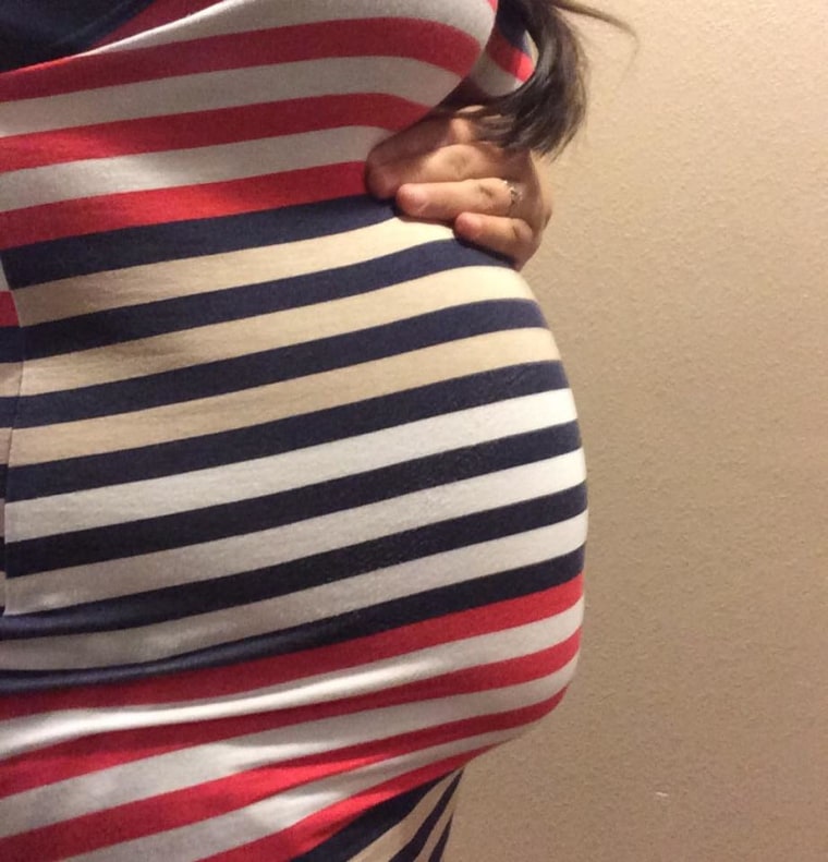 Chelsea Torres is pregnant with conjoined twins