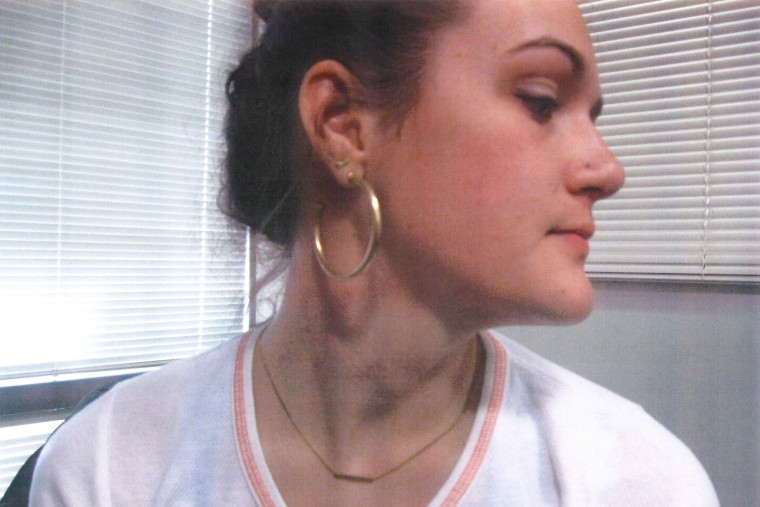 Apparent bruise marks on Delaney Robinson's neck.