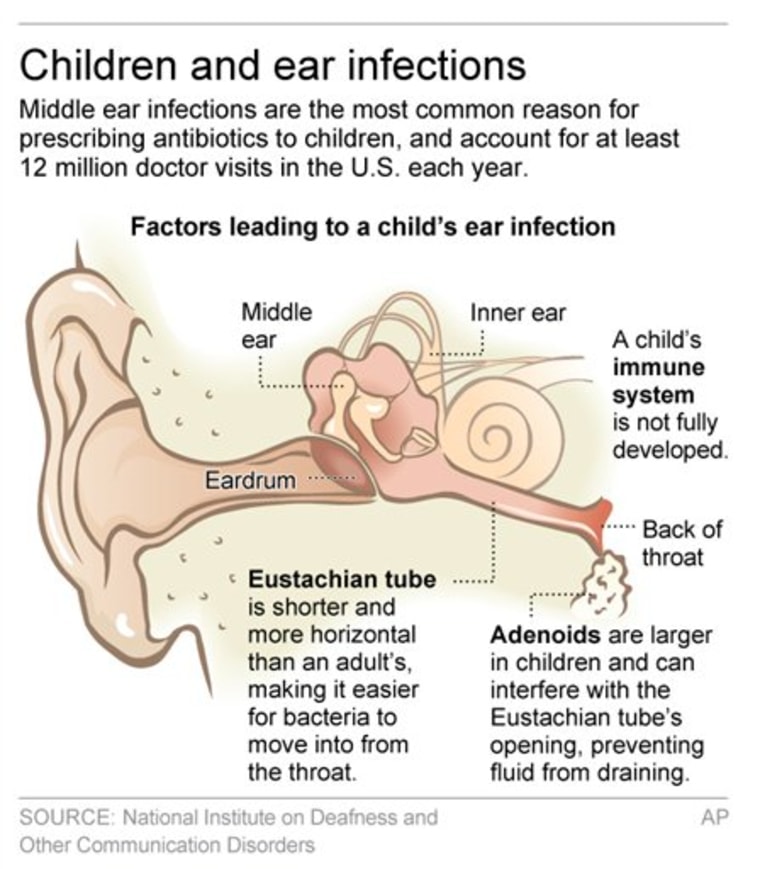 CHILD EAR INFECTIONS