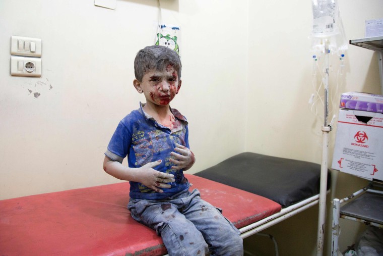 Image: A Syrian boy awaits treatment at a make-shift hospital in Aleppo Saturday.