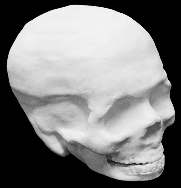 A Hyperelastic Bone human skull. Interior of the skull is hollow
