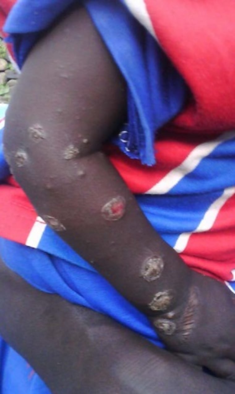 IMAGE: Victim of Sudan violence