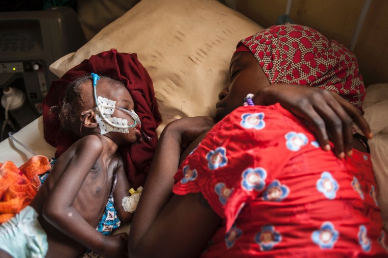 Image: TOPSHOT-NIGERIA-UNREST-BOKO-HARAM-MALNUTRITION-CHILDREN