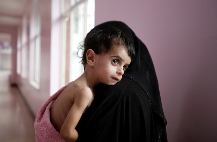 Image: Risk of famine looms in Yemen