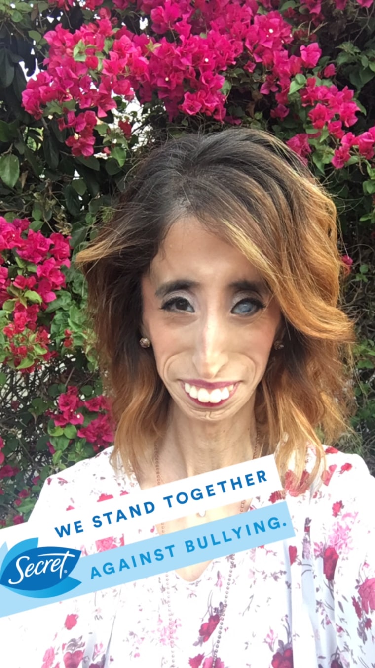 Lizzie Velasquez On Beating Back Bullies After Being Called World S Ugliest Woman