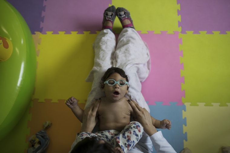 Image: Lucas Matheus, who was born with microcephaly