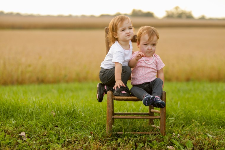 conjoined twins Selah and Shylah Oglesby