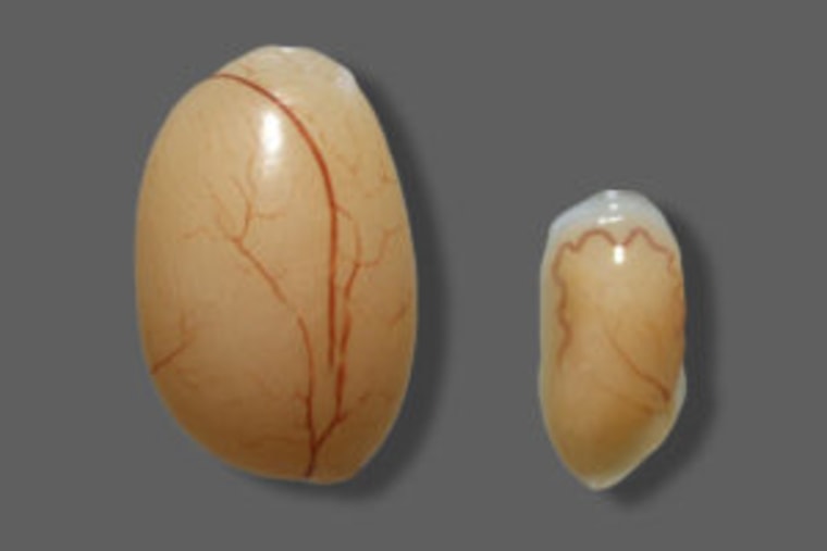 The testicles of male mice showed cellular damage and shrinkage three weeks after Zika infection. On the left is a healthy mouse testicle; on the right, a testicle following Zika infection.