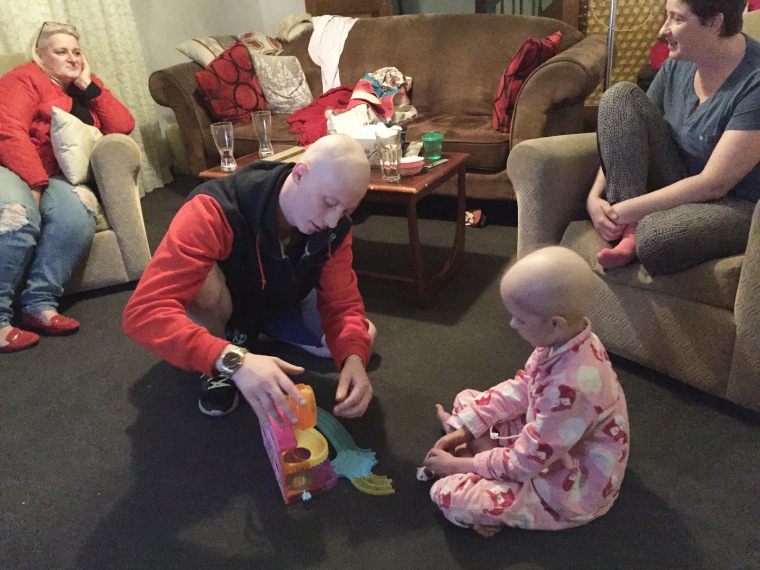 Dad takes a photo of his daughter, Hayley Brown's, last eyelash after cancer treatments.