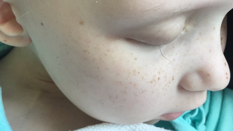 Dad takes a photo of his daughter, Hayley Brown's, last eyelash after cancer treatments.