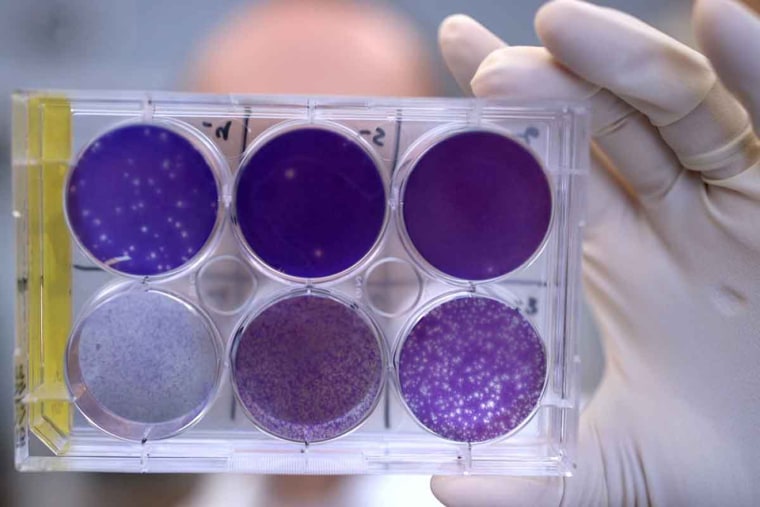 A researcher holds a tray of Zika virus growing in cells at Washington University School of Medicine in St. Louis. No treatments exist to block Zika virus in a pregnant woman from infecting her fetus and potentially causing severe birth defects. But now, researchers report that they have identified a human antibody that prevents -- in pregnant mice -- the fetus from becoming infected and damage to the placenta. The antibody also protects adult mice from Zika disease.
