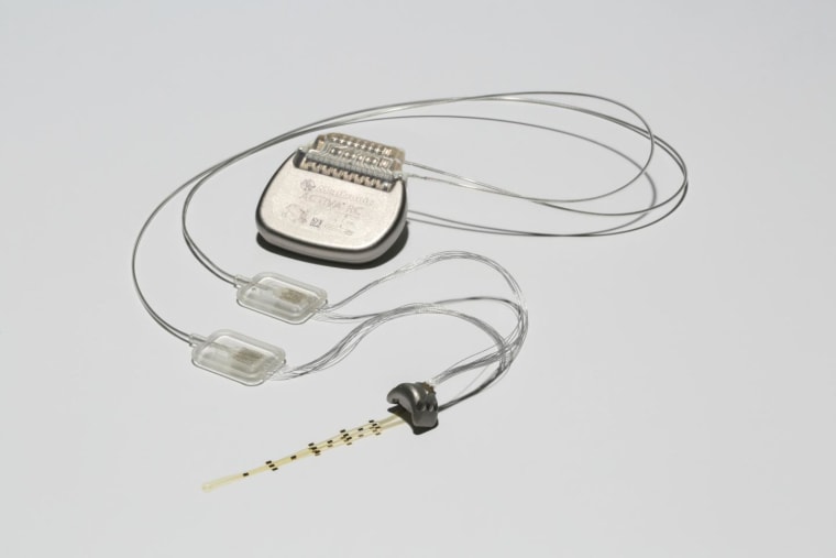 The brain-spine interface uses a brain implant like this one to detect spiking activity in the brain's motor cortex.