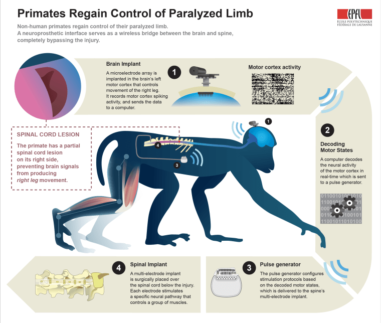 A neural interface helped a monkey walk again after its spinal cord was cut