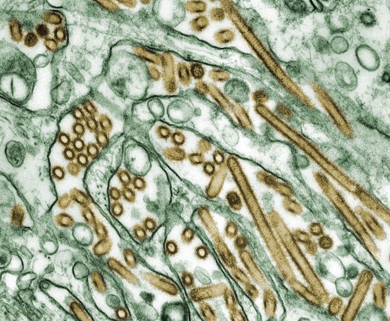 A new study explains why children and young adults are more likely to be infected with H5N1, shown here, while H7N9 disproportionately affects older adults.