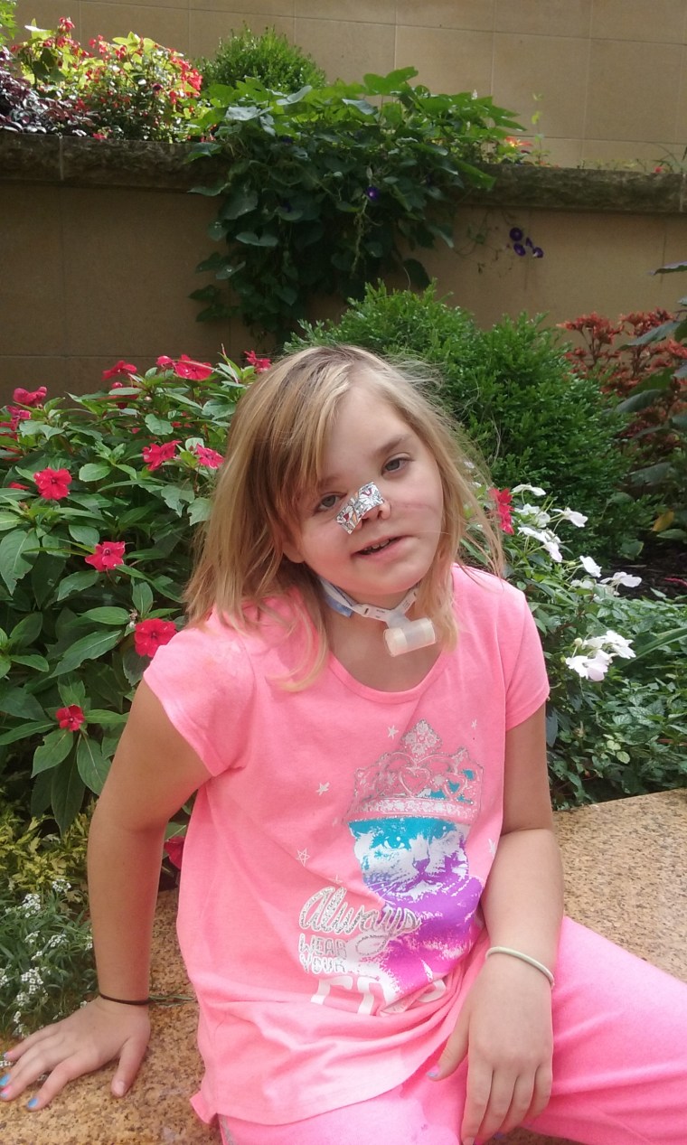 Amber-Rose Kordiak needed facial reconstruction surgery