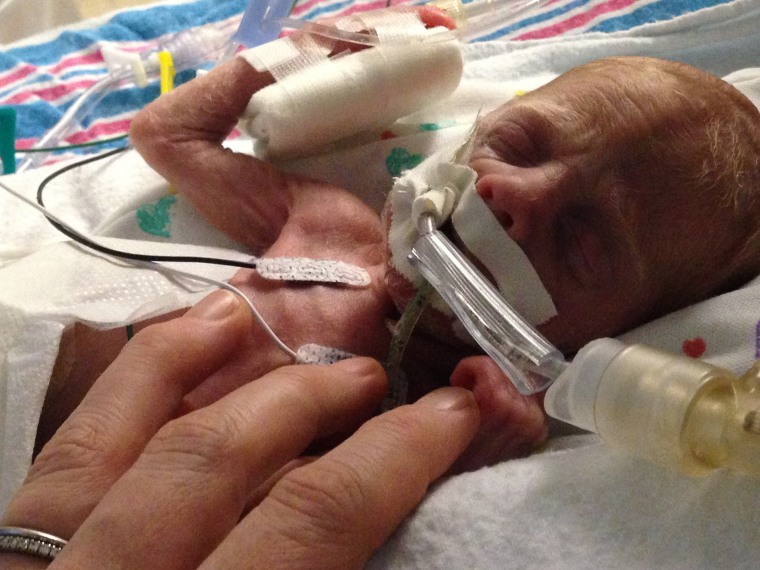 Wyatt was born four months premature. His mom says she was "not ready."