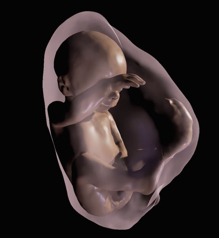Image: 3D virtual model MRI view of fetus at 26 weeks