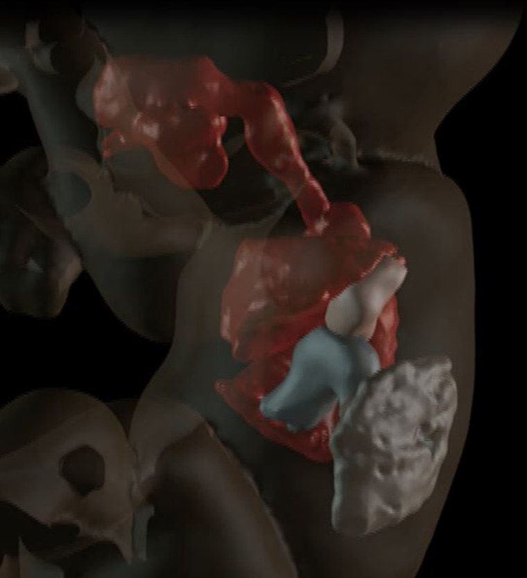 Image: Visualization of internal structures at 27 weeks
