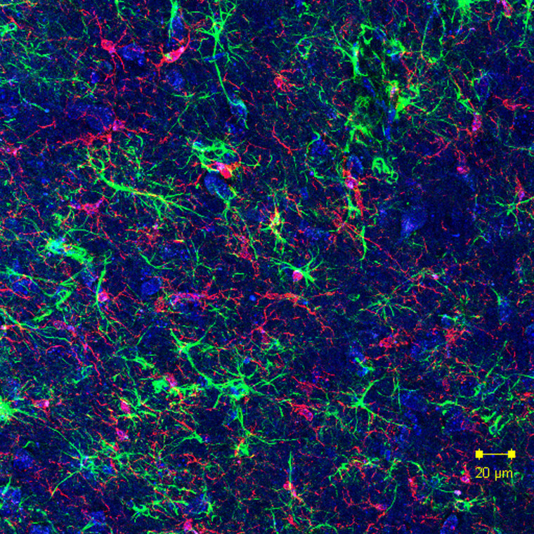 Gut microbes can initiate activation of microglia (brain-resident immune cells), which leads to the neuroinflammation that is characteristic of Parkinson's disease.