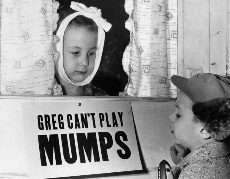 A Jan. 16, 1957 file photo shows Greg Cox, left, 7, in Altamont, Ill., as he looks at his friend Jon Douglas, 6, through the doorway while he recovers from mumps. Greg's parents posted the sign but it didn't working out too well because most of Greg's playmates were too young to read.