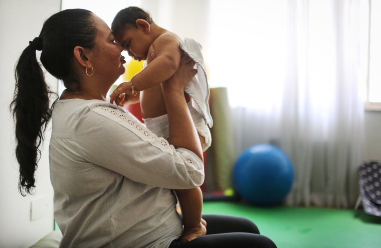 Image: Brazilian baby with microcephaly