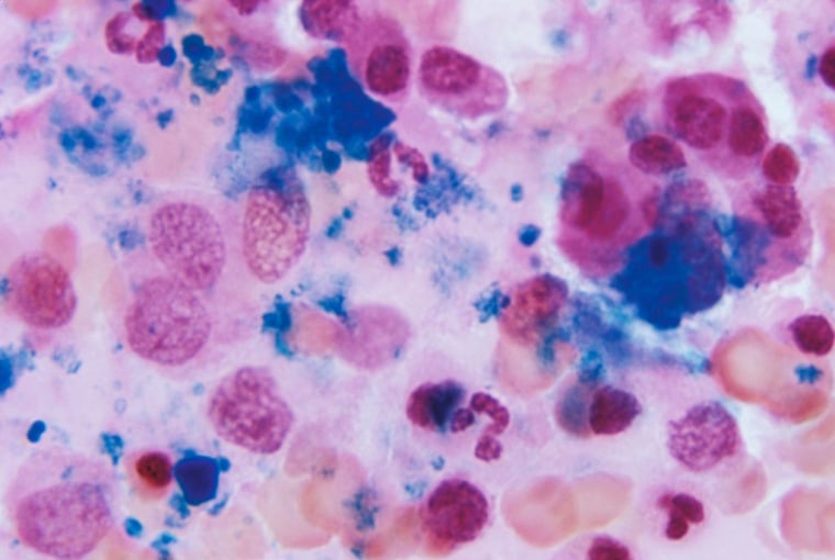 Bone Marrow Tissue