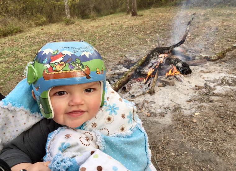 Amber Botkin chose a camping-themed helmet for her son, Owen, asking that Strawn also include the lyrics to Bob Marley hit "Three Little Birds" in the design. "Our family is relaxed and laid back, but any time you are dealing with something impacting your children, it can be difficult," said Botkin. "The helmet is a reminder that everything is going to be alright."