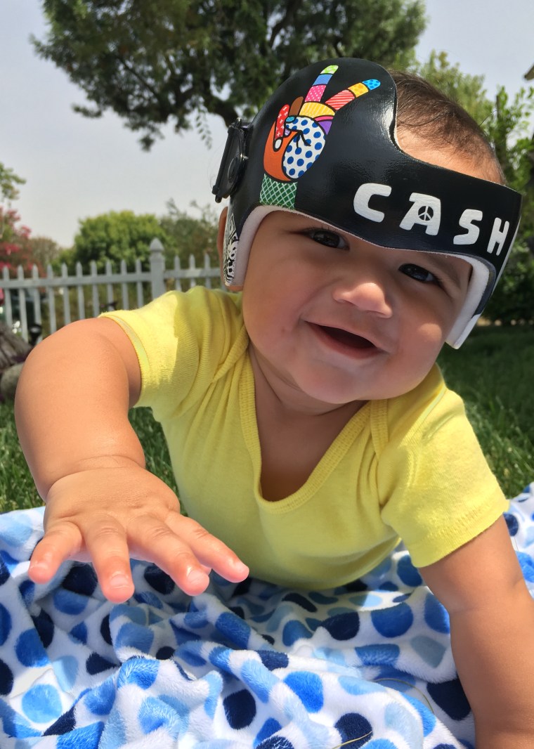 Lauren Katunich's husband, David, is a music producer. So when their son, Cash, needed a corrective helmet, the California couple requested that Strawn create a music-inspired headpiece for their baby. "Paula's designs have made a world of difference in what would otherwise have been a very depressing time," said Katunich.