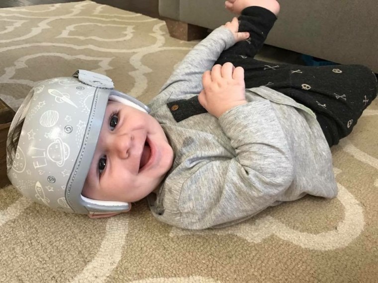 Stephanie Hanrahan says she struggled with seeing a piece of white plastic strapped to her infant son, Eli's, head. So the Texas mom contacted Strawn for some design help. "When your child is not the norm, it's easy to submit to helplessness," said Hanrahan. "Paula has used her beautiful talent to help parents feel empowered."