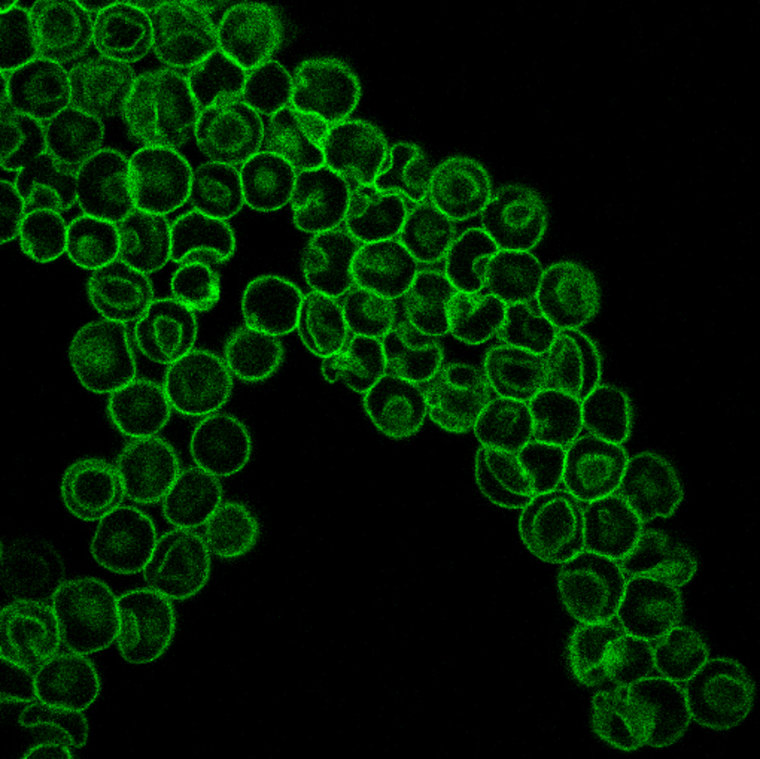 Image: Red blood cell membrane protein found in normal red cells is labelled green in the cells that have been grown in the laboratory