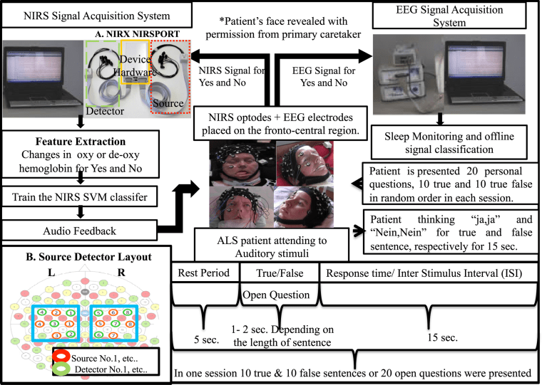 IMage: Brain-computer interface for communication in ALS patients