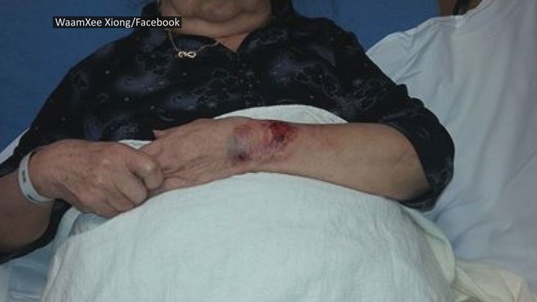 Choua Xiong was bitten by a police dog while working in her yard, according to her family.