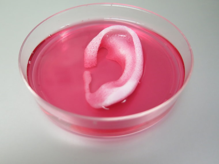 Image: 3D printed ear