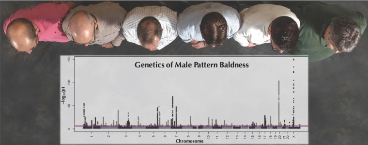 Genetics of male pattern baldness. University of Edinburgh researchers found 287 genes linked with hair loss