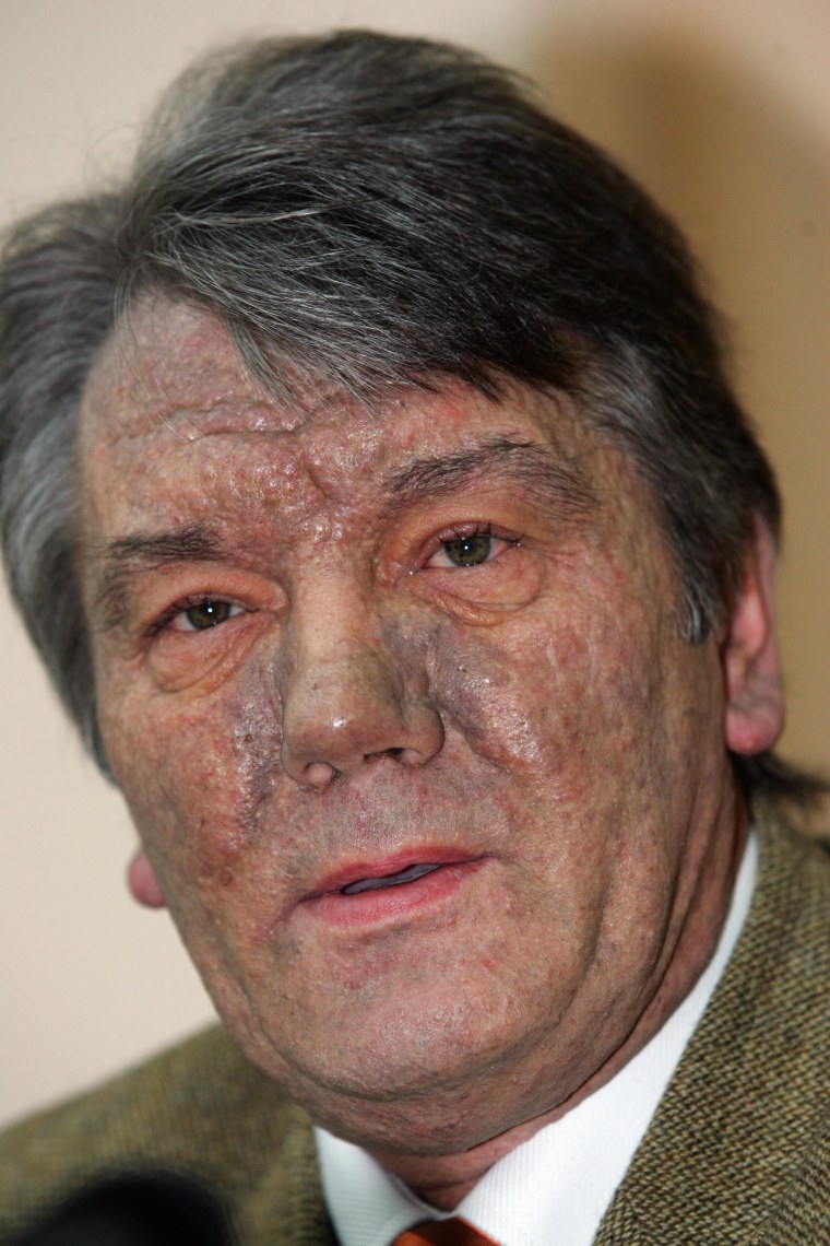 Image: Viktor Yushchenko