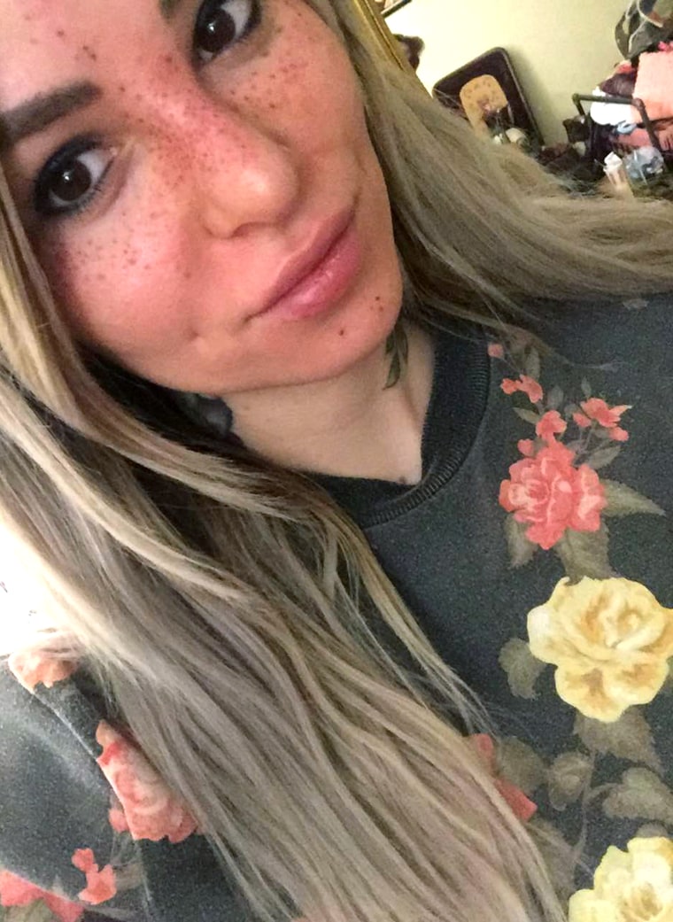 Tattoo artist Sydney Dyer shows off her newly applied freckle tattoos.