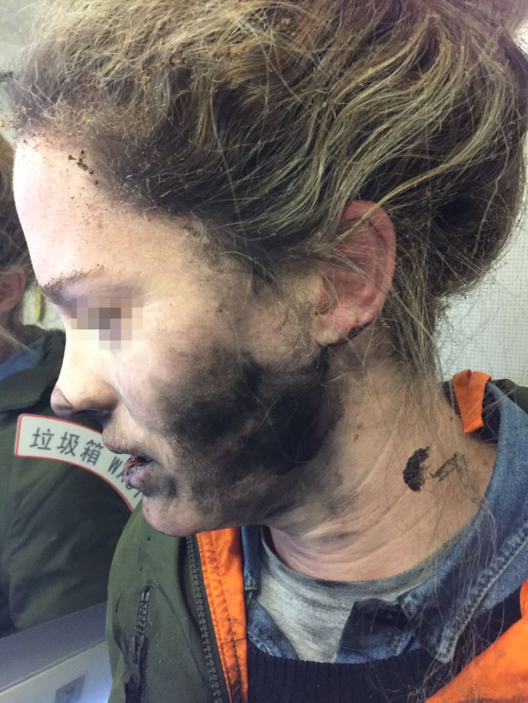 Image: A passenger was burned after the battery exploded while she was using battery-operated headphones on a flight