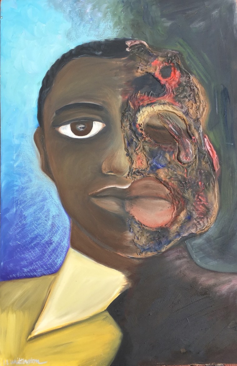 MuseumsSoWhite: Black Pain and Why Painting Emmett Till Matters