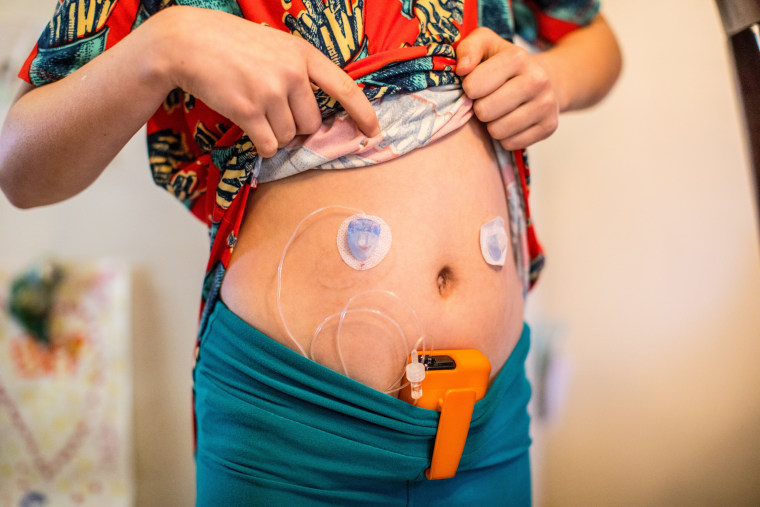 Image: Gabriella Corley wears an insulin pump