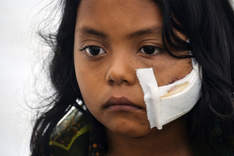 Image: A wounded girl waits for medical attention at a shelter in Mocoa
