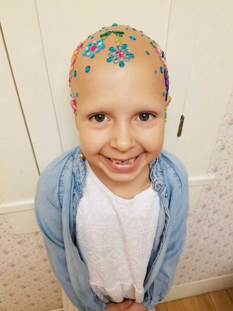 Girl with alopecia