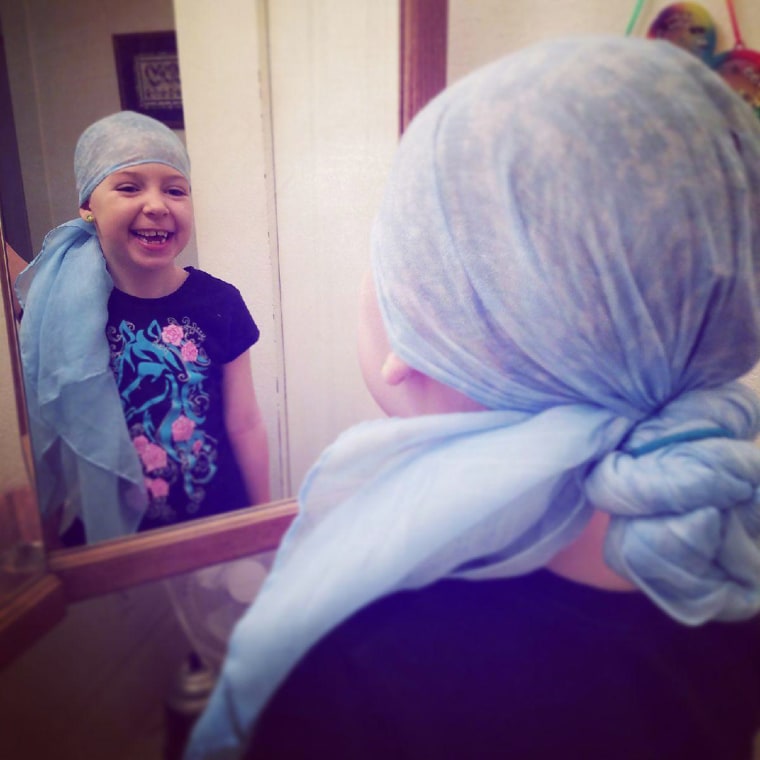 Girl with alopecia