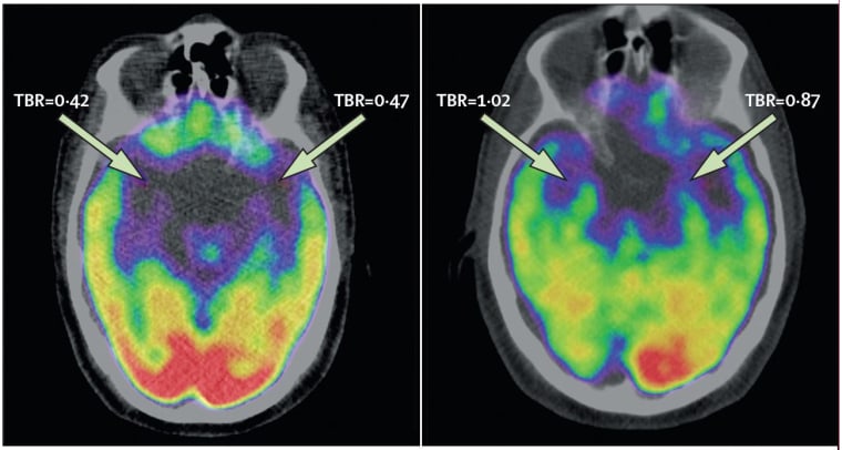 Image: Brain scan