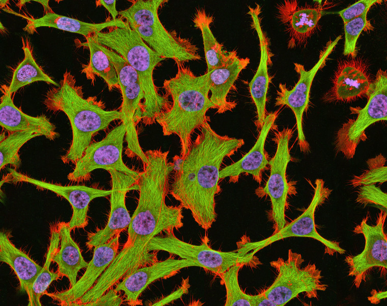 Image: HeLa Cells