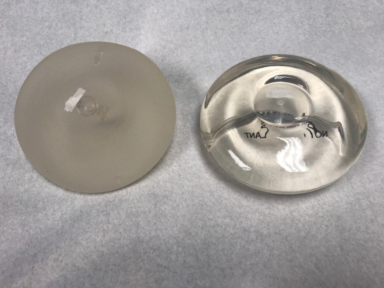 textured versus smooth breast implants