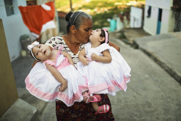 Image: Brazilian Twins Born With Zika Celebrate Their First Birthday